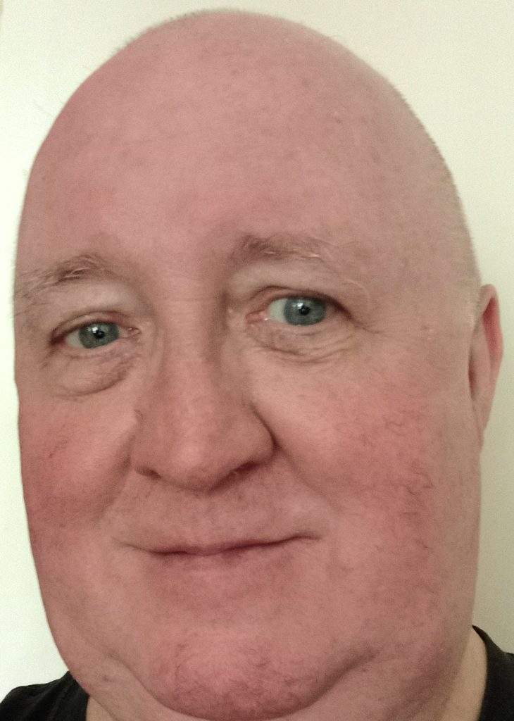 Image of Fraser